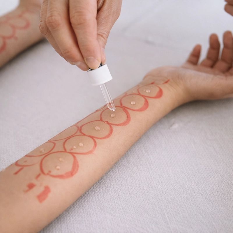 Prick Test per Allergie